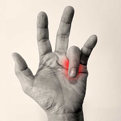 Schnappfinger